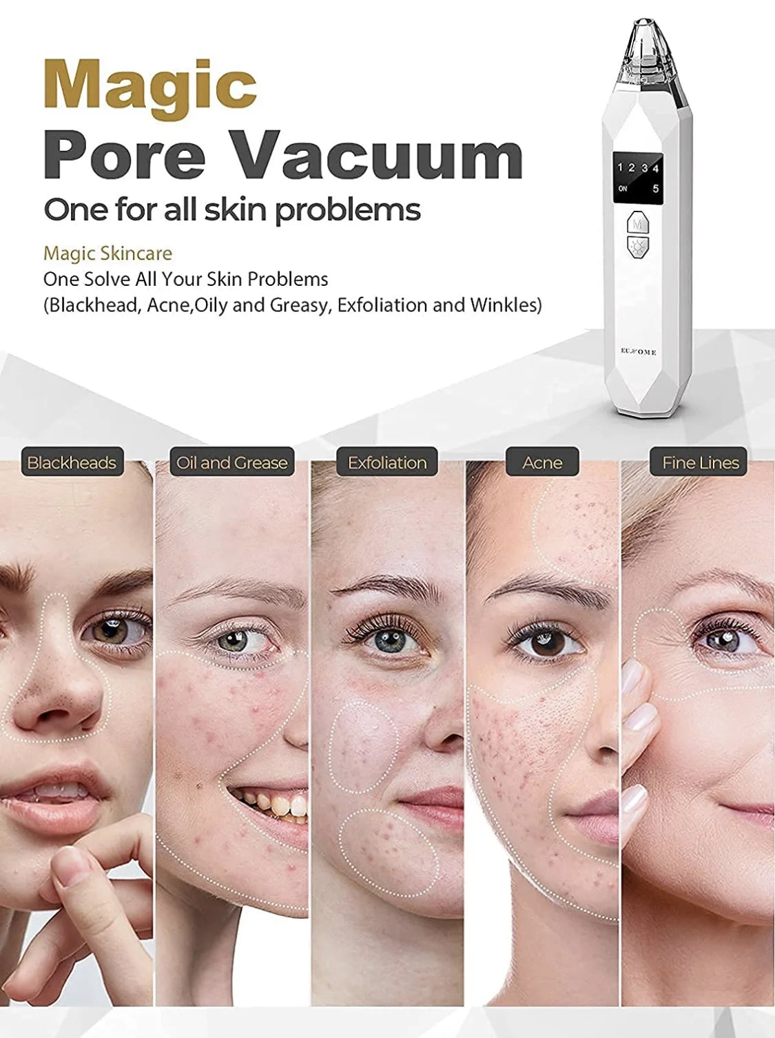 Removedor de Puntos Negros | Recargable, 5 Cabeales + Pantalla LED